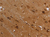 The image on the left is immunohistochemistry of paraffin-embedded Human brain tissue using CSB-PA985162 (FLNA Antibody) at dilution 1/40, on the right is treated with fusion protein. (Original magnification: ×200)