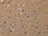 The image on the left is immunohistochemistry of paraffin-embedded Human brain tissue using CSB-PA073623 (GALK1 Antibody) at dilution 1/40, on the right is treated with fusion protein. (Original magnification: ×200)