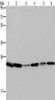 Gel: 10%SDS-PAGE, Lysate: 40 μg, Lane 1-6: Mouse spleen tissue, A375 cells, A549 cells, HT29 cells, mouse lung tissue, Hela cells, Primary antibody: CSB-PA192321 (ARHGDIA Antibody) at dilution 1/400, Secondary antibody: Goat anti rabbit IgG at 1/8000 dilution, Exposure time: 10 seconds