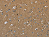 The image on the left is immunohistochemistry of paraffin-embedded Human brain tissue using CSB-PA198597 (PAEP Antibody) at dilution 1/60, on the right is treated with fusion protein. (Original magnification: ×200)
