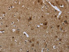 The image on the left is immunohistochemistry of paraffin-embedded Human brain tissue using CSB-PA180065 (GYPC Antibody) at dilution 1/60, on the right is treated with fusion protein. (Original magnification: ×200)