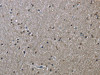 The image on the left is immunohistochemistry of paraffin-embedded Human brain tissue using CSB-PA104816 (HSPA9 Antibody) at dilution 1/50, on the right is treated with fusion protein. (Original magnification: ×200) The image on the left is immunohistochemistry of paraffin-embedded Human brain tissue using CSB-PA104816 (HSPA9 Antibody) at dilution 1/50, on the right is treated with fusion protein. (Original magnification: ×200)