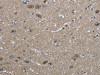 The image on the left is immunohistochemistry of paraffin-embedded Human brain tissue using CSB-PA933674 (HSPA9 Antibody) at dilution 1/50, on the right is treated with fusion protein. (Original magnification: ×200)