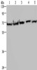 Gel: 8%SDS-PAGE, Lysate: 40 μg, Lane 1-5: HT29 cells, A549 cells, 293T cells, MCF7 cells, Hela cells, Primary antibody: CSB-PA933674 (HSPA9 Antibody) at dilution 1/300, Secondary antibody: Goat anti rabbit IgG at 1/8000 dilution, Exposure time: 10 seconds