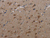 The image on the left is immunohistochemistry of paraffin-embedded Human brain tissue using CSB-PA053347 (LETMD1 Antibody) at dilution 1/30, on the right is treated with fusion protein. (Original magnification: ×200)