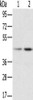 Gel: 8%SDS-PAGE, Lysate: 40 μg, Lane 1-2: Hela cells, K562 cells, Primary antibody: CSB-PA948825 (RBMX Antibody) at dilution 1/800, Secondary antibody: Goat anti rabbit IgG at 1/8000 dilution, Exposure time: 5 seconds