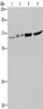 Gel: 8%SDS-PAGE, Lysate: 40 μg, Lane 1-4: Human testis tissue, mouse liver tissue, Hela cells, 293T cells, Primary antibody: CSB-PA546627 (HACL1 Antibody) at dilution 1/200, Secondary antibody: Goat anti rabbit IgG at 1/8000 dilution, Exposure time: 5 minutes