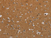 The image on the left is immunohistochemistry of paraffin-embedded Human brain tissue using CSB-PA077659 (CSH1 Antibody) at dilution 1/40, on the right is treated with fusion protein. (Original magnification: ×200)