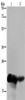 Gel: 10%SDS-PAGE, Lysate: 40 μg, Lane 1-2: Human placenta tissue, Human breast infiltrative duct tissue, Primary antibody: CSB-PA077659 (CSH1 Antibody) at dilution 1/200, Secondary antibody: Goat anti rabbit IgG at 1/8000 dilution, Exposure time: 10 seconds