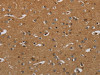 The image on the left is immunohistochemistry of paraffin-embedded Human brain tissue using CSB-PA960706 (HSD17B2 Antibody) at dilution 1/50, on the right is treated with fusion protein. (Original magnification: ×200)