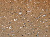 The image on the left is immunohistochemistry of paraffin-embedded Human brain tissue using CSB-PA101238 (HSD17B2 Antibody) at dilution 1/50, on the right is treated with fusion protein. (Original magnification: ×200)