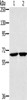 Gel: 6%SDS-PAGE, Lysate: 40 μg, Lane 1-2: Huvec cells, K562 cells, Primary antibody: CSB-PA287281 (HSD17B4 Antibody) at dilution 1/200, Secondary antibody: Goat anti rabbit IgG at 1/8000 dilution, Exposure time: 10 seconds