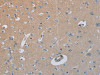 The image on the left is immunohistochemistry of paraffin-embedded Human brain tissue using CSB-PA972922 (HSD3B7 Antibody) at dilution 1/40, on the right is treated with fusion protein. (Original magnification: ×200) The image on the left is immunohistochemistry of paraffin-embedded Human brain tissue using CSB-PA972922 (HSD3B7 Antibody) at dilution 1/40, on the right is treated with fusion protein. (Original magnification: ×200)