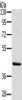 Gel: 8%SDS-PAGE, Lysate: 40 μg, Lane: Skov3 cells, Primary antibody: CSB-PA919270 (HSD3B7 Antibody) at dilution 1/400, Secondary antibody: Goat anti rabbit IgG at 1/8000 dilution, Exposure time: 10 seconds