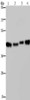 Gel: 8%SDS-PAGE, Lysate: 40 μg, Lane 1-4: HepG2 cells, Raji cells, A431 cells, 231 cells, Primary antibody: CSB-PA201270 (DNAJA1 Antibody) at dilution 1/800, Secondary antibody: Goat anti rabbit IgG at 1/8000 dilution, Exposure time: 5 seconds