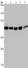 Gel: 8%SDS-PAGE, Lysate: 40 μg, Lane 1-5: 231 cells, A431 cells, Raji cells, Jurkat cells, HepG2 cells, Primary antibody: CSB-PA180704 (DNAJA1 Antibody) at dilution 1/500, Secondary antibody: Goat anti rabbit IgG at 1/8000 dilution, Exposure time: 5 seconds