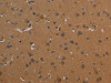 The image on the left is immunohistochemistry of paraffin-embedded Human brain tissue using CSB-PA440434 (ICAM4 Antibody) at dilution 1/30, on the right is treated with fusion protein. (Original magnification: ×200)