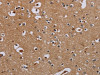 The image on the left is immunohistochemistry of paraffin-embedded Human brain tissue using CSB-PA698625 (IFRD1 Antibody) at dilution 1/40, on the right is treated with fusion protein. (Original magnification: ×200)