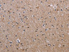 The image on the left is immunohistochemistry of paraffin-embedded Human brain tissue using CSB-PA183080 (FCGR3A Antibody) at dilution 1/60, on the right is treated with fusion protein. (Original magnification: ×200)