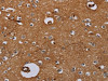 The image on the left is immunohistochemistry of paraffin-embedded Human brain tissue using CSB-PA953889 (IL27RA Antibody) at dilution 1/40, on the right is treated with fusion protein. (Original magnification: ×200)