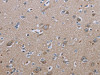 The image on the left is immunohistochemistry of paraffin-embedded Human brain tissue using CSB-PA298467 (IL27RA Antibody) at dilution 1/40, on the right is treated with fusion protein. (Original magnification: ×200)