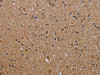 The image on the left is immunohistochemistry of paraffin-embedded Human brain tissue using CSB-PA082388 (IL2RG Antibody) at dilution 1/30, on the right is treated with fusion protein. (Original magnification: ×200)