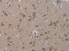 The image on the left is immunohistochemistry of paraffin-embedded Human brain tissue using CSB-PA034458 (INSIG2 Antibody) at dilution 1/30, on the right is treated with fusion protein. (Original magnification: ×200)