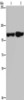 Gel: 6%SDS-PAGE, Lysate: 40 μg, Lane 1-2: Human fetal liver tissue, Human placenta tissue, Primary antibody: CSB-PA249653 (ITGA2B Antibody) at dilution 1/200, Secondary antibody: Goat anti rabbit IgG at 1/8000 dilution, Exposure time: 3 minutes