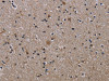 The image on the left is immunohistochemistry of paraffin-embedded Human brain tissue using CSB-PA877324 (ITGB2 Antibody) at dilution 1/50, on the right is treated with fusion protein. (Original magnification: ×200)
