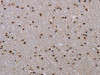 The image on the left is immunohistochemistry of paraffin-embedded Human brain tissue using CSB-PA988498 (JMJD6 Antibody) at dilution 1/40, on the right is treated with fusion protein. (Original magnification: ×200)