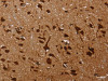 The image on the left is immunohistochemistry of paraffin-embedded Human brain tissue using CSB-PA163096 (KARS Antibody) at dilution 1/60, on the right is treated with fusion protein. (Original magnification: ×200)