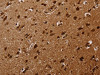 The image on the left is immunohistochemistry of paraffin-embedded Human brain tissue using CSB-PA056745 (KARS Antibody) at dilution 1/30, on the right is treated with fusion protein. (Original magnification: ×200)