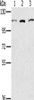 Gel: 6%SDS-PAGE, Lysate: 40 μg, Lane 1-3: K562 cells, 293T cells, hela cells, Primary antibody: CSB-PA966542 (KIF20A Antibody) at dilution 1/400, Secondary antibody: Goat anti rabbit IgG at 1/8000 dilution, Exposure time: 10 seconds