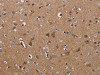 The image on the left is immunohistochemistry of paraffin-embedded Human brain tissue using CSB-PA061054 (KLHL1 Antibody) at dilution 1/30, on the right is treated with fusion protein. (Original magnification: ×200)