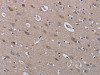 The image on the left is immunohistochemistry of paraffin-embedded Human brain tissue using CSB-PA242915 (LEPREL2 Antibody) at dilution 1/40, on the right is treated with fusion protein. (Original magnification: ×200)