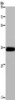 Gel: 8%SDS-PAGE, Lysate: 40 μg, Lane: Mouse lung tissue, Primary antibody: CSB-PA795414 (LIMS1 Antibody) at dilution 1/200, Secondary antibody: Goat anti rabbit IgG at 1/8000 dilution, Exposure time: 3 minutes