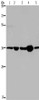 Gel: 8%SDS-PAGE, Lysate: 40 μg, Lane 1-5: Human transitional cell carcinoma tissue, 293T cells, A172 cells, human testis tissue, Hela cells, Primary antibody: CSB-PA217118 (LZTFL1 Antibody) at dilution 1/550, Secondary antibody: Goat anti rabbit IgG at 1/8000 dilution, Exposure time: 20 seconds