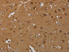 The image on the left is immunohistochemistry of paraffin-embedded Human brain tissue using CSB-PA269153 (TAB1 Antibody) at dilution 1/50, on the right is treated with fusion protein. (Original magnification: ×200)