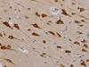 The image is immunohistochemistry of paraffin-embedded Human brain tissue using CSB-PA133615 (TAB3 Antibody) at dilution 1/25. (Original magnification: ×200)