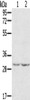 Gel: 8%SDS-PAGE, Lysate: 40 μg, Lane 1-2: 231 cells, A172 cells, Primary antibody: CSB-PA248639 (WDR83 Antibody) at dilution 1/300, Secondary antibody: Goat anti rabbit IgG at 1/8000 dilution, Exposure time: 5 minutes
