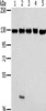 Gel: 6%SDS-PAGE, Lysate: 40 μg, Lane 1-5: NIH/3T3 cells, 231 cells, hela cells, K562 cells, 293T cells, Primary antibody: CSB-PA272764 (MATR3 Antibody) at dilution 1/400, Secondary antibody: Goat anti rabbit IgG at 1/8000 dilution, Exposure time: 3 seconds