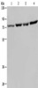 Gel: 8%SDS-PAGE, Lysate: 40 μg, Lane 1-4: A549 cells, PC3 cells, Hela cells, LoVo cells, Primary antibody: CSB-PA175056 (PABPC1 Antibody) at dilution 1/500, Secondary antibody: Goat anti rabbit IgG at 1/8000 dilution, Exposure time: 10 seconds