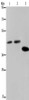 Gel: 8%SDS-PAGE, Lysate: 40 μg, Lane 1-3: Hela cells, 293T cells, LO2 cells, Primary antibody: CSB-PA188248 (SERPINB3 Antibody) at dilution 1/400, Secondary antibody: Goat anti rabbit IgG at 1/8000 dilution, Exposure time: 10 seconds