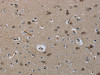 The image on the left is immunohistochemistry of paraffin-embedded Human brain tissue using CSB-PA056873 (MRE11A Antibody) at dilution 1/60, on the right is treated with fusion protein. (Original magnification: ×200)