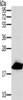 Gel: 10%SDS-PAGE, Lysate: 40 μg, Lane: 293T cells, Primary antibody: CSB-PA259631 (MRPL12 Antibody) at dilution 1/300, Secondary antibody: Goat anti rabbit IgG at 1/8000 dilution, Exposure time: 5 seconds