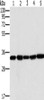 Gel: 10%SDS-PAGE, Lysate: 40 μg, Lane 1-5: Human testis tissue, K562 cells, PC3 cells, human liver cancer tissue, hela cells, Primary antibody: CSB-PA083456 (MTCH2 Antibody) at dilution 1/400, Secondary antibody: Goat anti rabbit IgG at 1/8000 dilution, Exposure time: 40 seconds