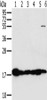 Gel: 10%SDS-PAGE, Lysate: 40 μg, Lane 1-6: Mouse heart tissue, Mouse muscle tissue, hela cells, mouse liver tissue tissue, mouse kidney tissue, hepg2 cells, Primary antibody: CSB-PA296860 (MTFP1 Antibody) at dilution 1/450, Secondary antibody: Goat anti rabbit IgG at 1/8000 dilution, Exposure time: 5 seconds