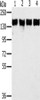 Gel: 6%SDS-PAGE, Lysate: 40 μg, Lane 1-4: NIH/3T3 cells, A172 cells, hela cells, PC3 cells, Primary antibody: CSB-PA270132 (PPP1R12A Antibody) at dilution 1/350, Secondary antibody: Goat anti rabbit IgG at 1/8000 dilution, Exposure time: 40 seconds