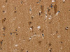 The image on the left is immunohistochemistry of paraffin-embedded Human brain tissue using CSB-PA923759 (NGFRAP1 Antibody) at dilution 1/40, on the right is treated with fusion protein. (Original magnification: ×200)