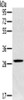 Gel: 10%SDS-PAGE, Lysate: 40 μg, Lane: Human testis tissue, Primary antibody: CSB-PA347049 (CLIC1 Antibody) at dilution 1/400, Secondary antibody: Goat anti rabbit IgG at 1/8000 dilution, Exposure time: 1 minute